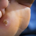 7 Common Foot Problems and How to Treat Them: An Expert's Perspective