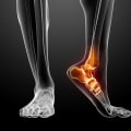 The Role of Podiatrists in Foot and Lower Leg Health