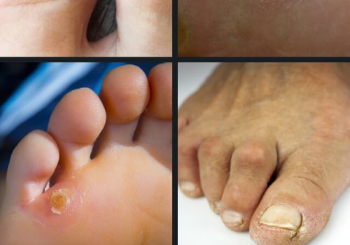 Expert's Guide to Common Foot Disorders