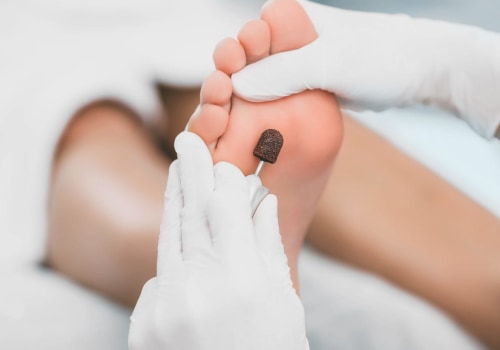Expert Insights: The Most Common Conditions Treated by Podiatrists