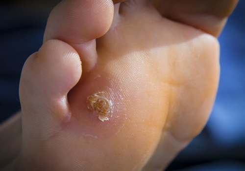 The Most Common Foot Problems and How to Treat Them: An Expert's Perspective