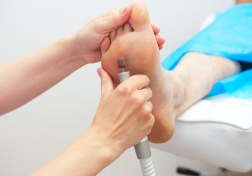 Chiropodist Vs Podiatrist? A First-Rate Podiatrist Helps You Make The Right Choice