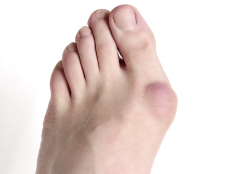 Expert Tips for Treating Painful Foot Conditions