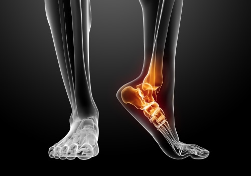 The Role of Podiatrists in Foot and Lower Leg Health